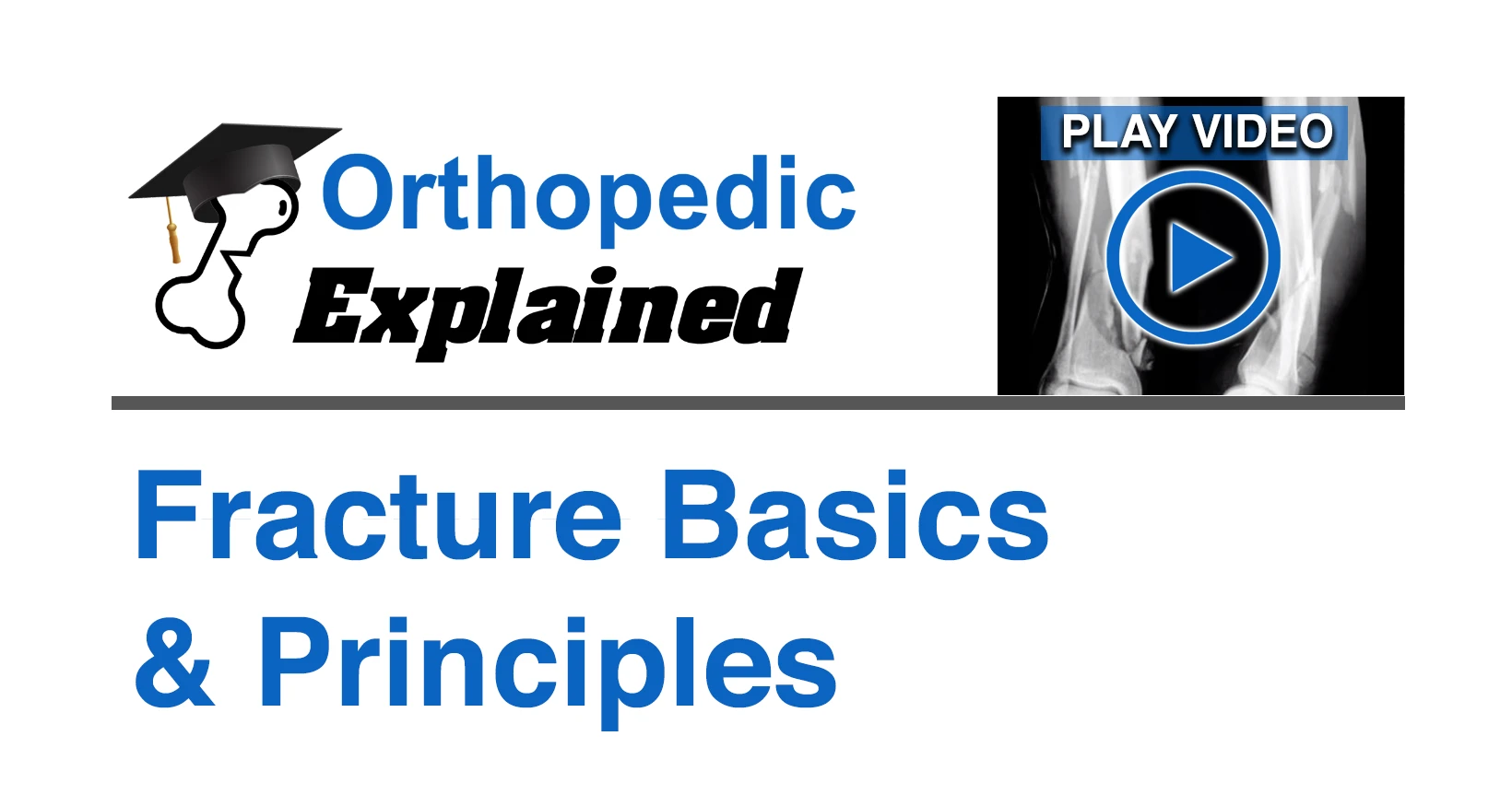 Fracture Basics & Principles