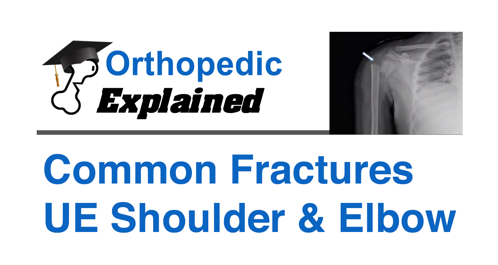 Common Fractures Upper