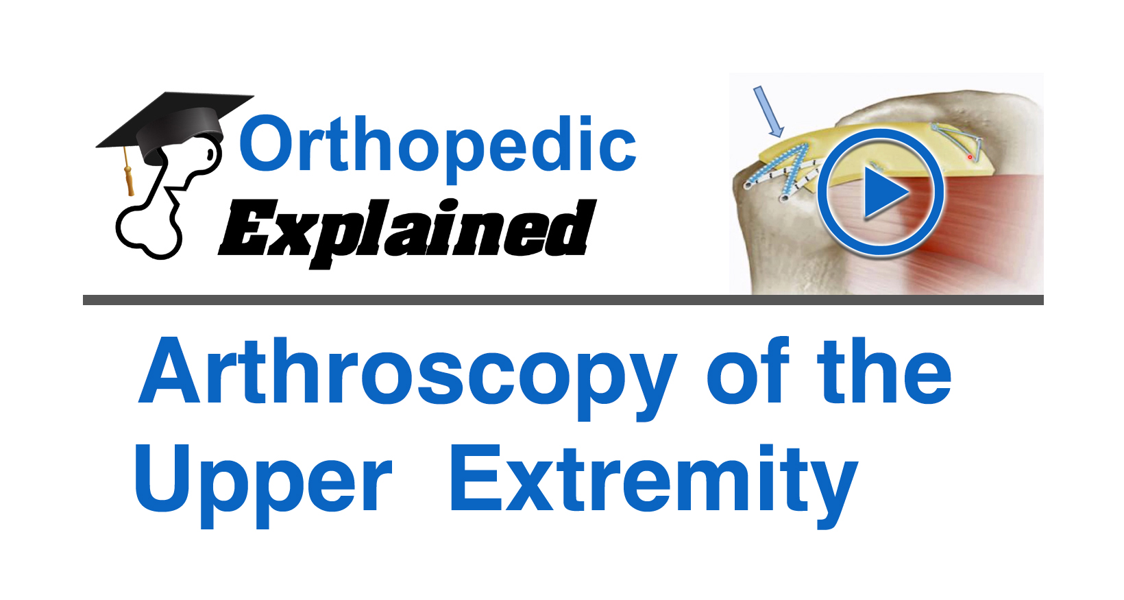 Arthroscopy of the Upper Extremity