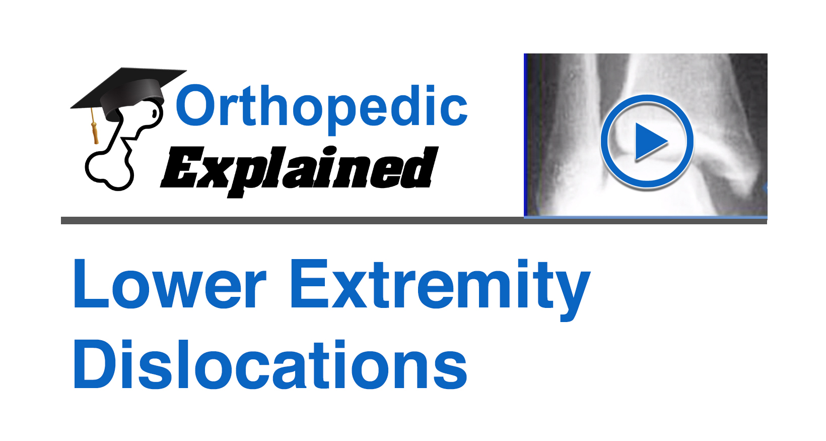 Lower Extremity Dislocations