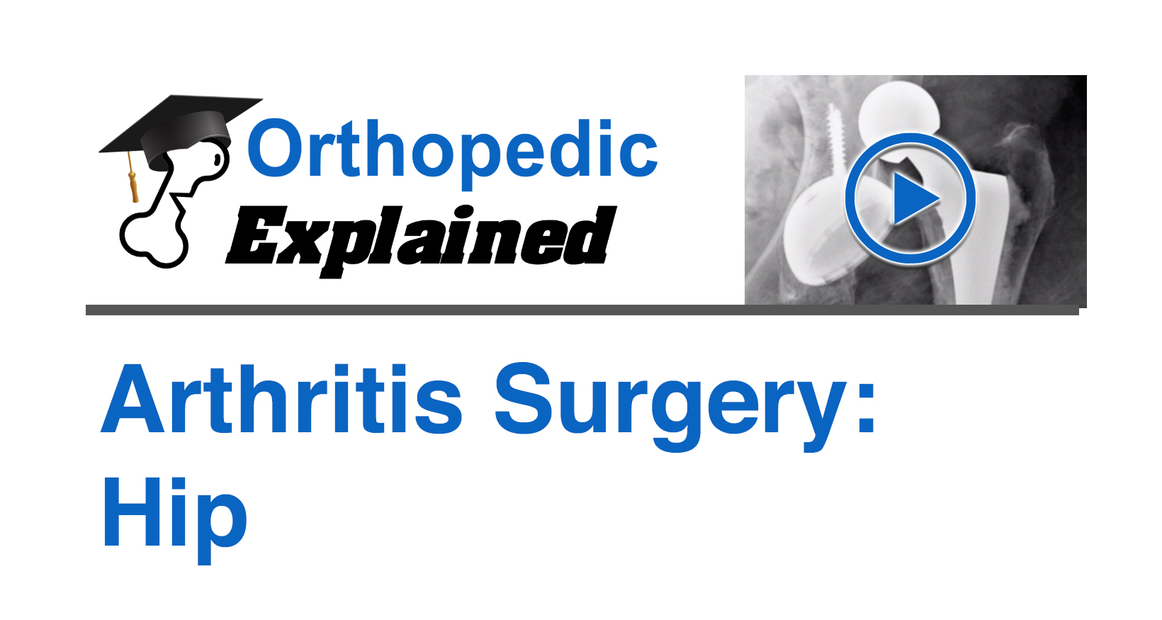 Arthritis Surgery: Hip