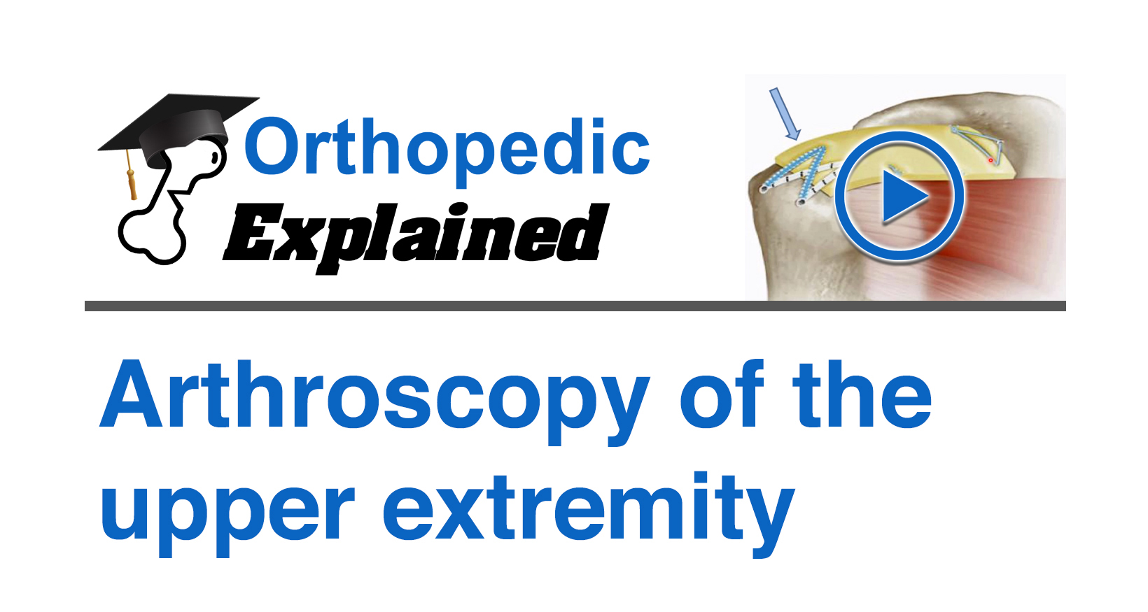 Arthroscopy of the upper extremity