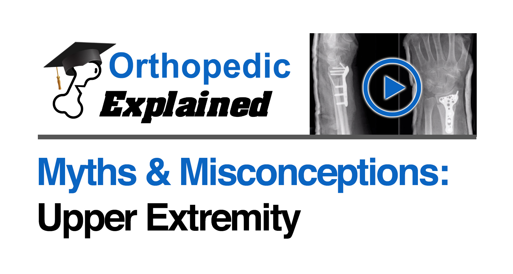 Myths & Misconceptions-Upper Extremity