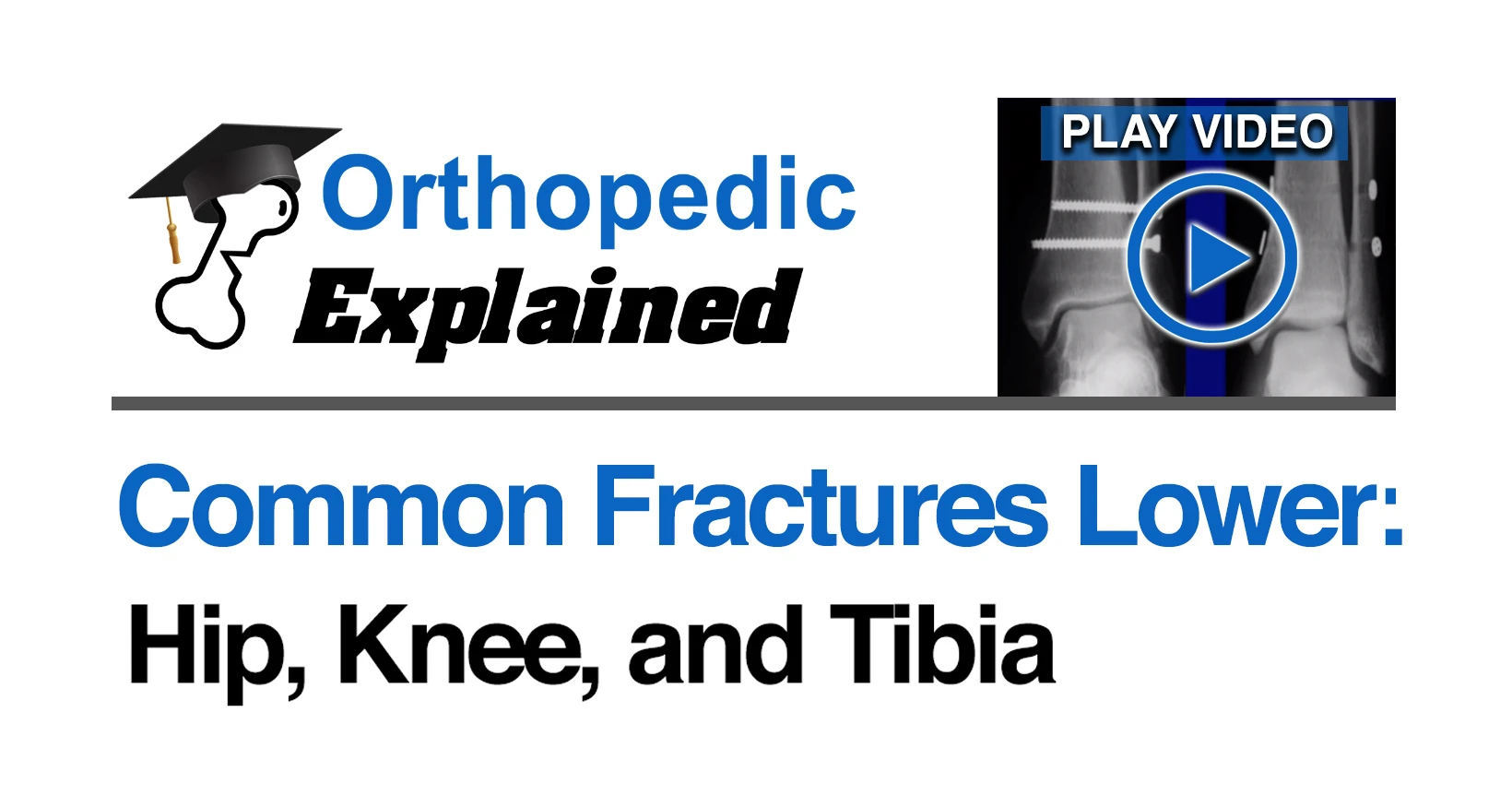 Common Fractures of the Hip, Knee & Tibia