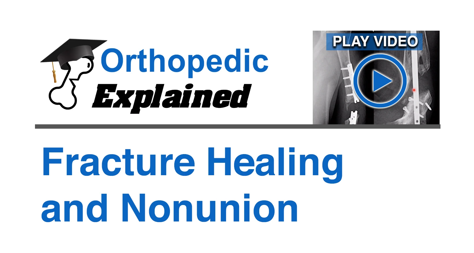 Fractures of the ankle and foot