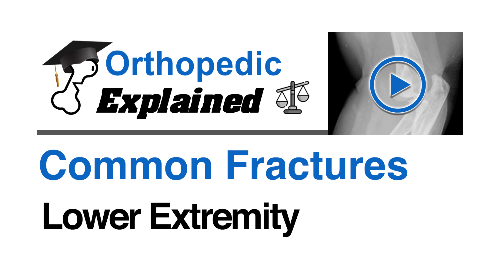 (FF) Common Fractures of the Lower Extremity (Law)