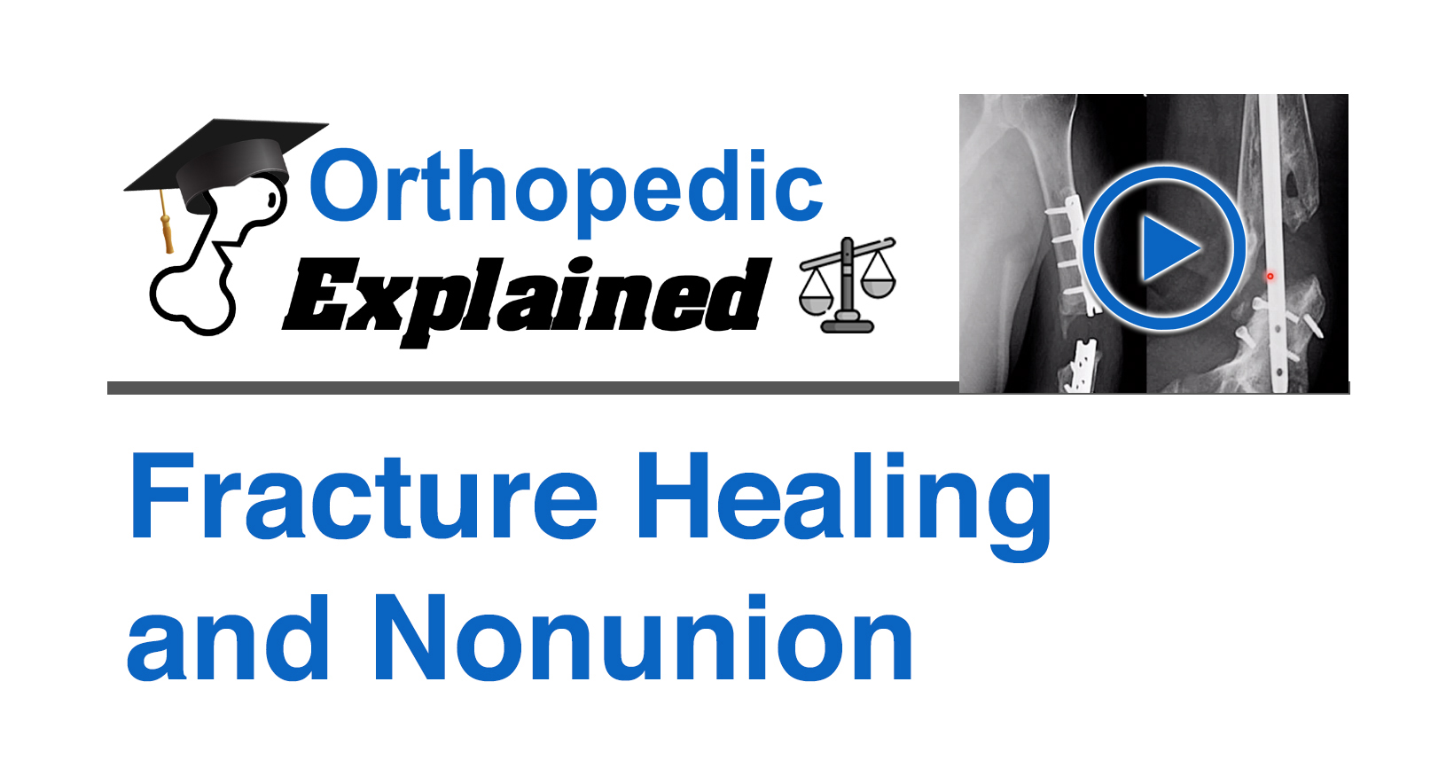 (DH) Fracture Healing and Nonunion (Law)