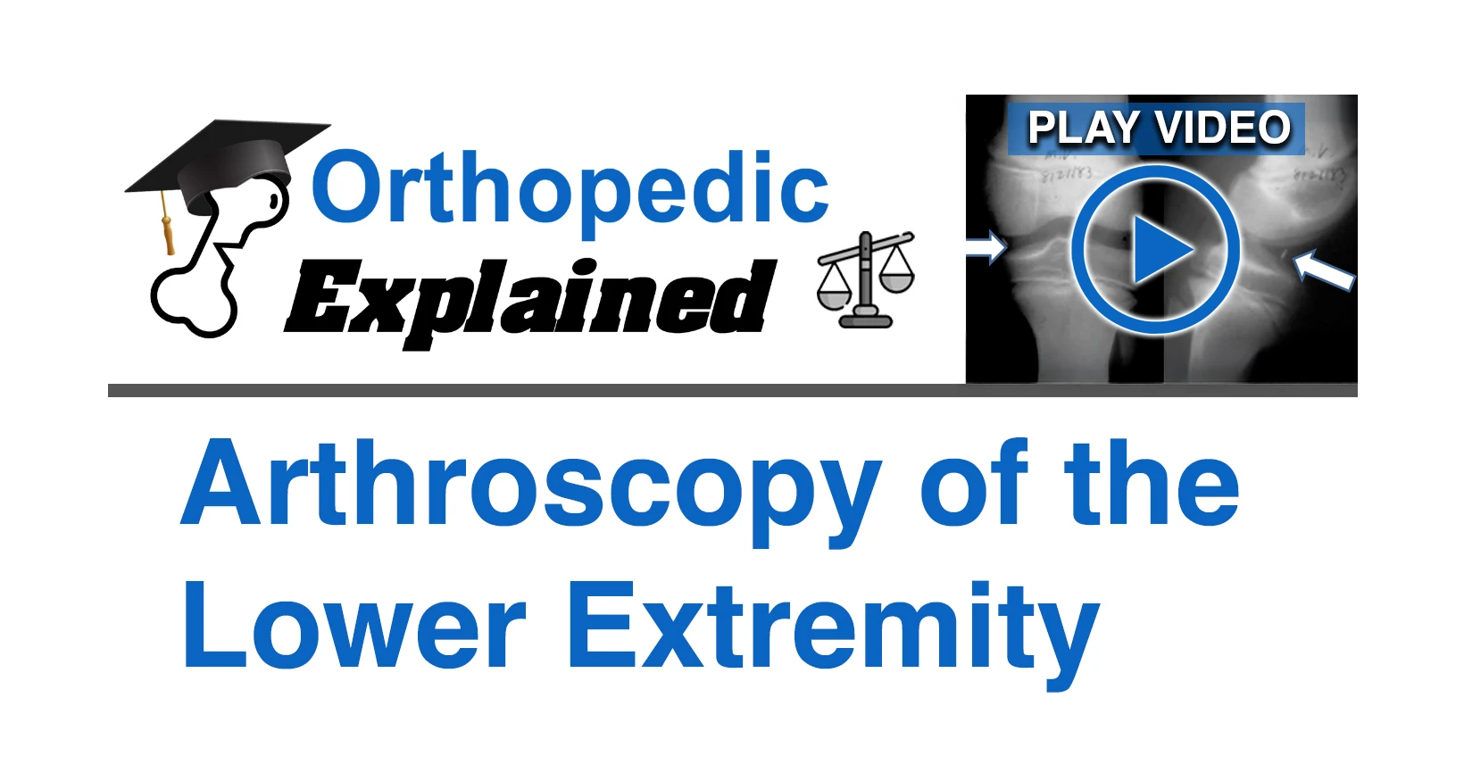 Arthroscopy of the lower extremity.